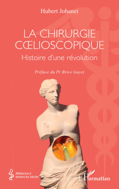 La chirurgie cœlioscopique